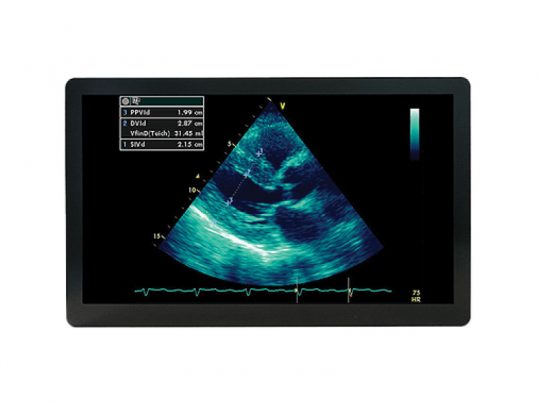 Wamee 24" medical grade monitor